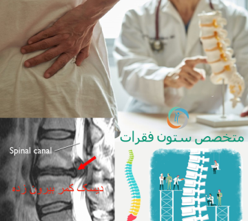 متخصص ستون فقرات