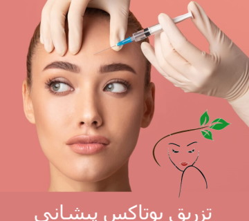 بوتاکس پیشانی