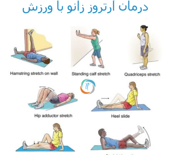 درمان آرتروز زانو با ورزش