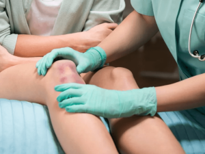 متخصص زانو تهران