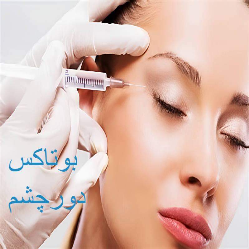 بوتاکس دورچشم