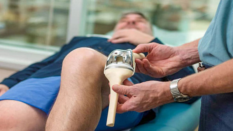 متخصص زانو تهران