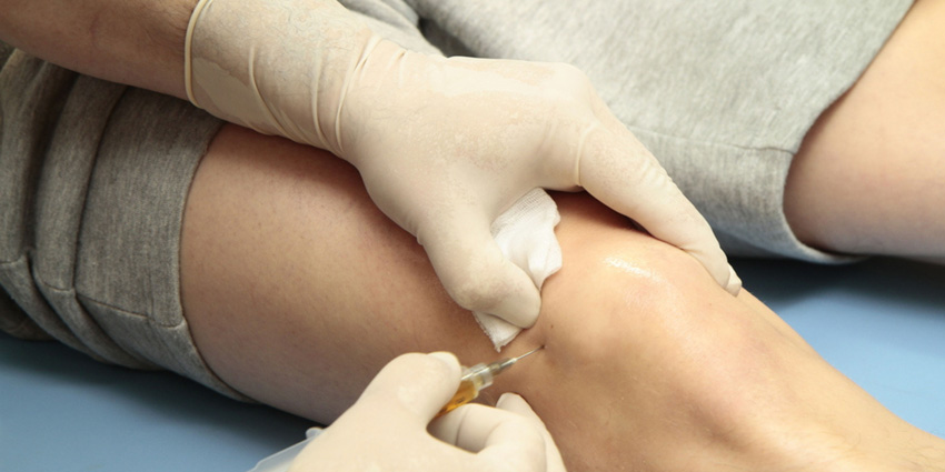 تزریق پی آر پی