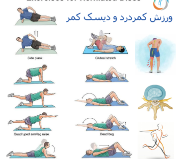 ورزش درمانی دیسک کمر مهره 4و5