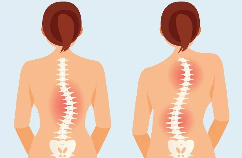 متخصص ستون فقرات