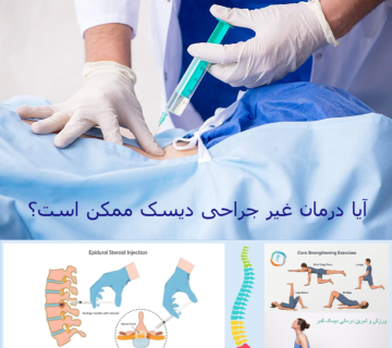 آیا درمان غیر جراحی دیسک ممکن است؟