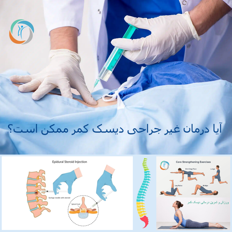 روش های درمان غیر جراحی دیسک