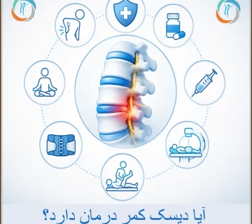 آیا دیسک کمر درمان دارد؟