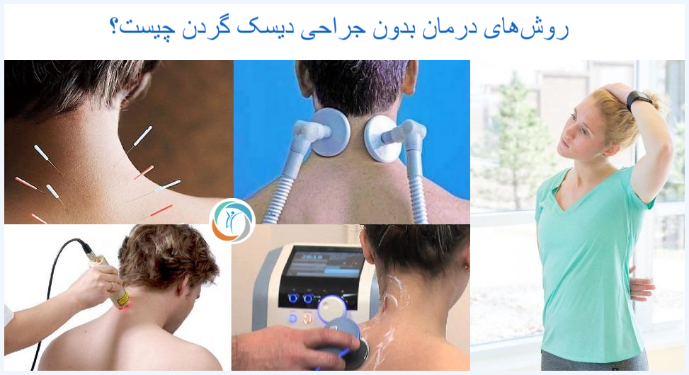روش‌های درمان بدون جراحی دیسک گردن چیست؟