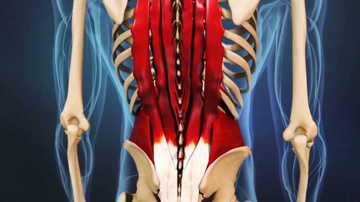 گرفتگی عضلات کمر