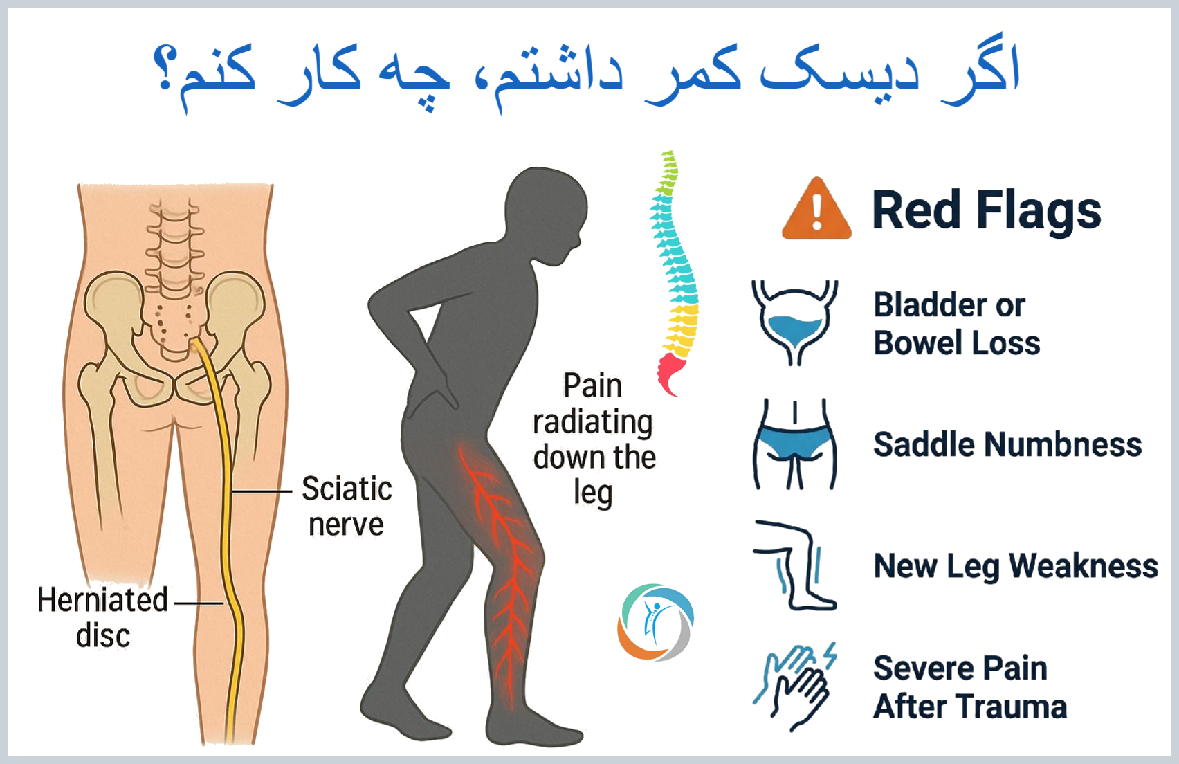 اگر دیسک کمر دارم، چه زمانی باید به متخصص مراجعه کنم؟