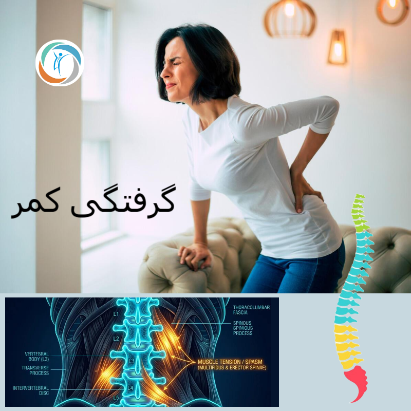 گرفتگی کمر نشانه چیست؟