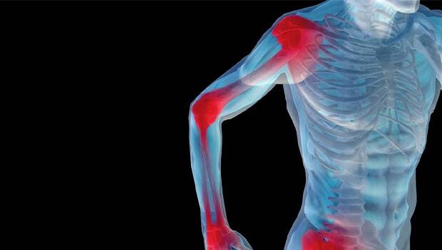 پلی میالژیا روماتیکا