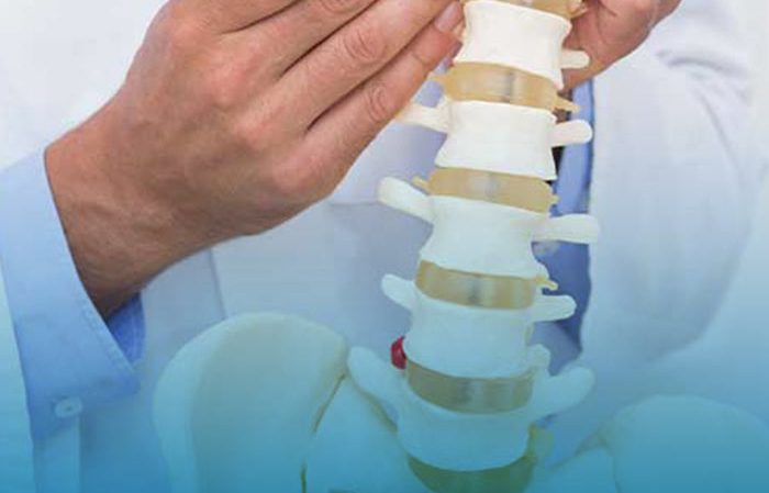 درمان روماتیسم ستون فقرات