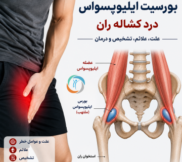بورسیت ایلیوپسواس؛ درد کشاله ران