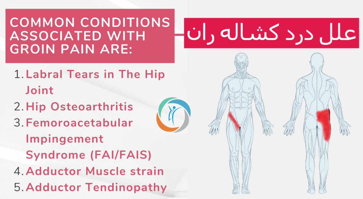 تفاوت بورسیت ایلیوپسواس با سایر علل درد کشاله ران