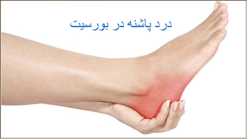 علائم بورسیت پاشنه پا