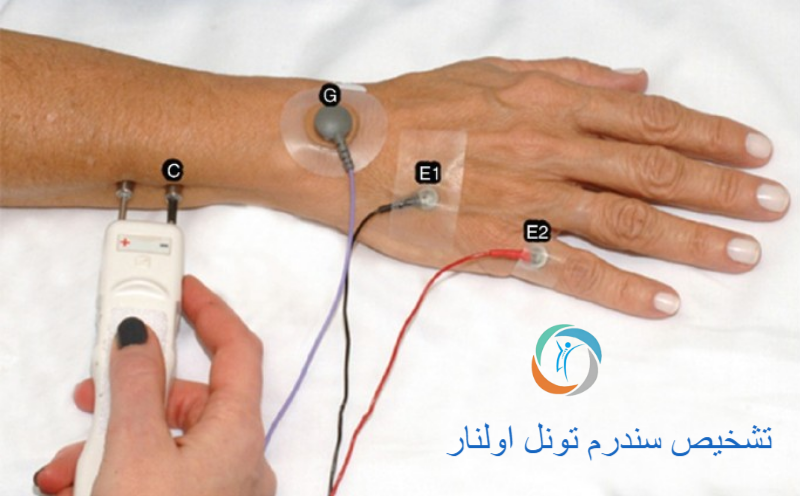 تشخیص سندرم تونل اولنار