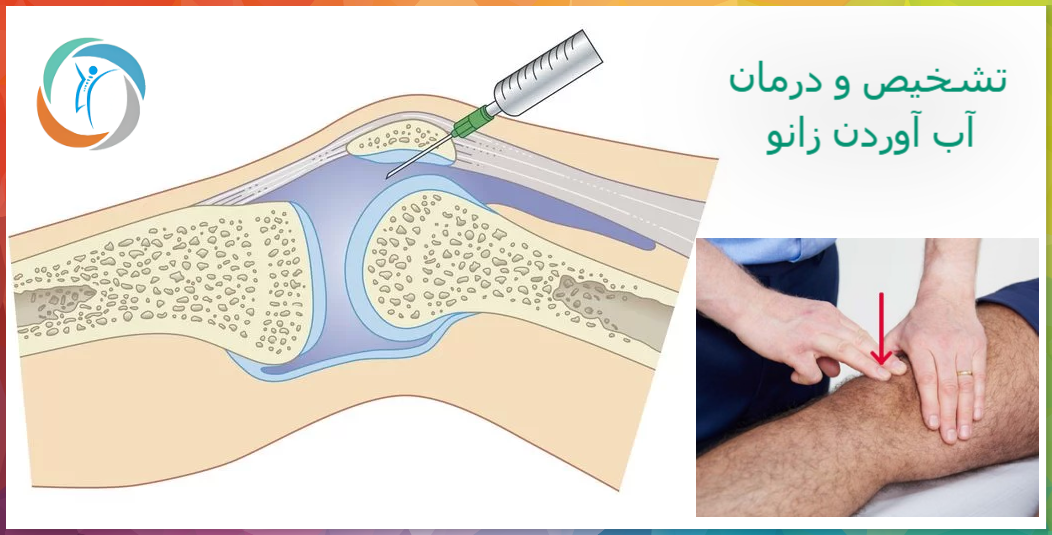 تشخیص و درمان آب آوردن زانو
