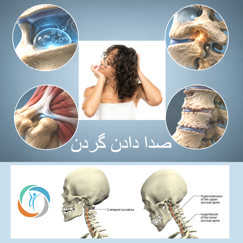 صدا دادن گردن