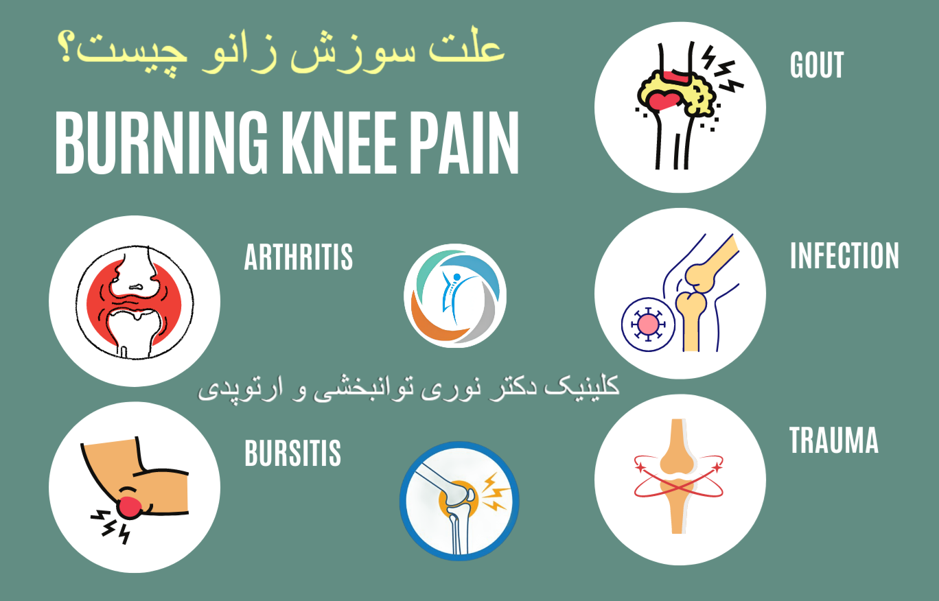 علت سوزش زانو چیست؟
