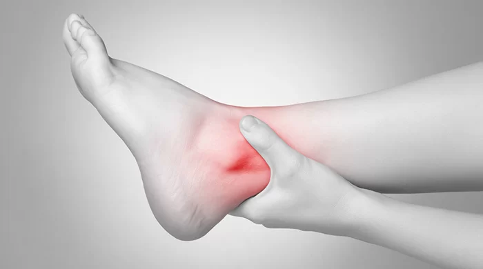 علت درد مچ پا
