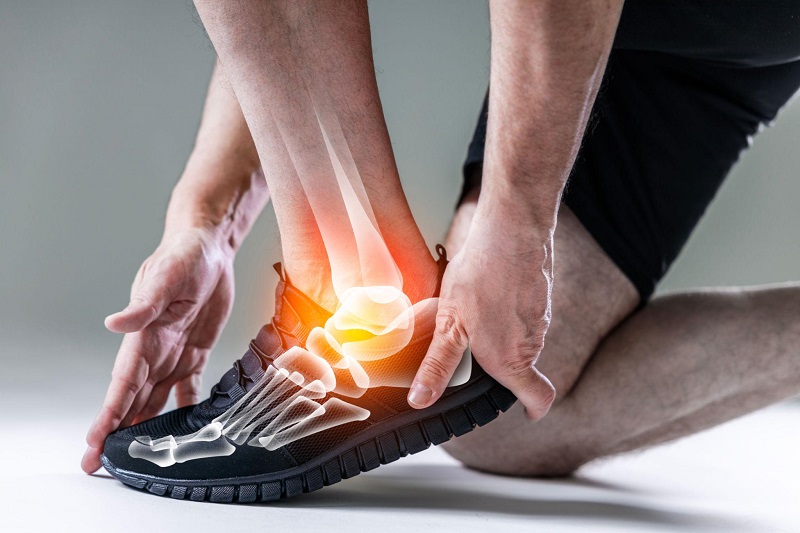 آرتروز مچ پا به چه دلایلی ایجاد می‌شود؟