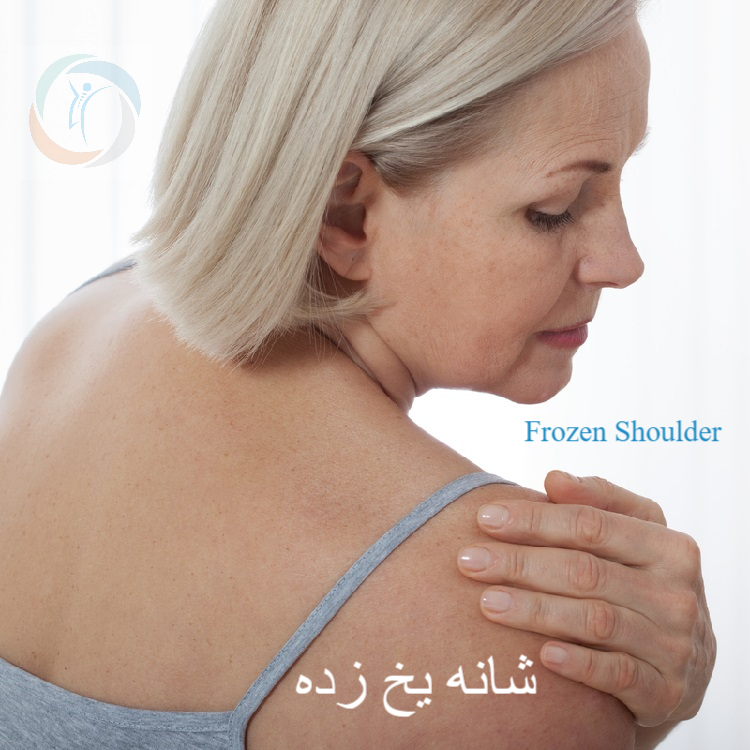 شانه یخ زده