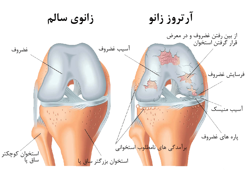 متخصص زانو تهران