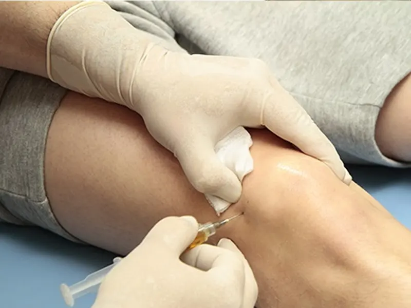 پی آر پی زانو