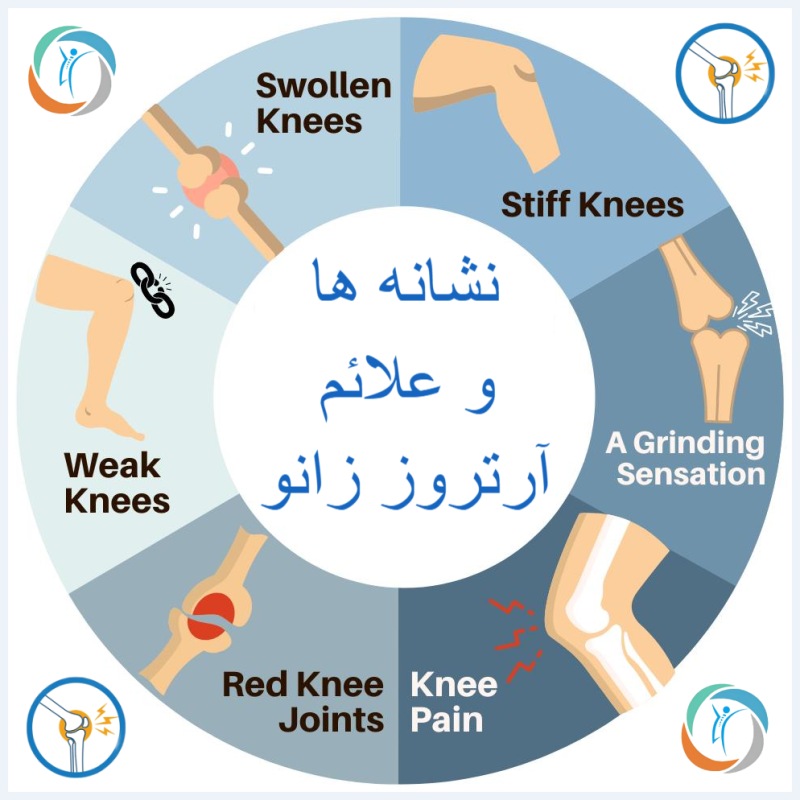 نشانه ها و علائم آرتروز زانو