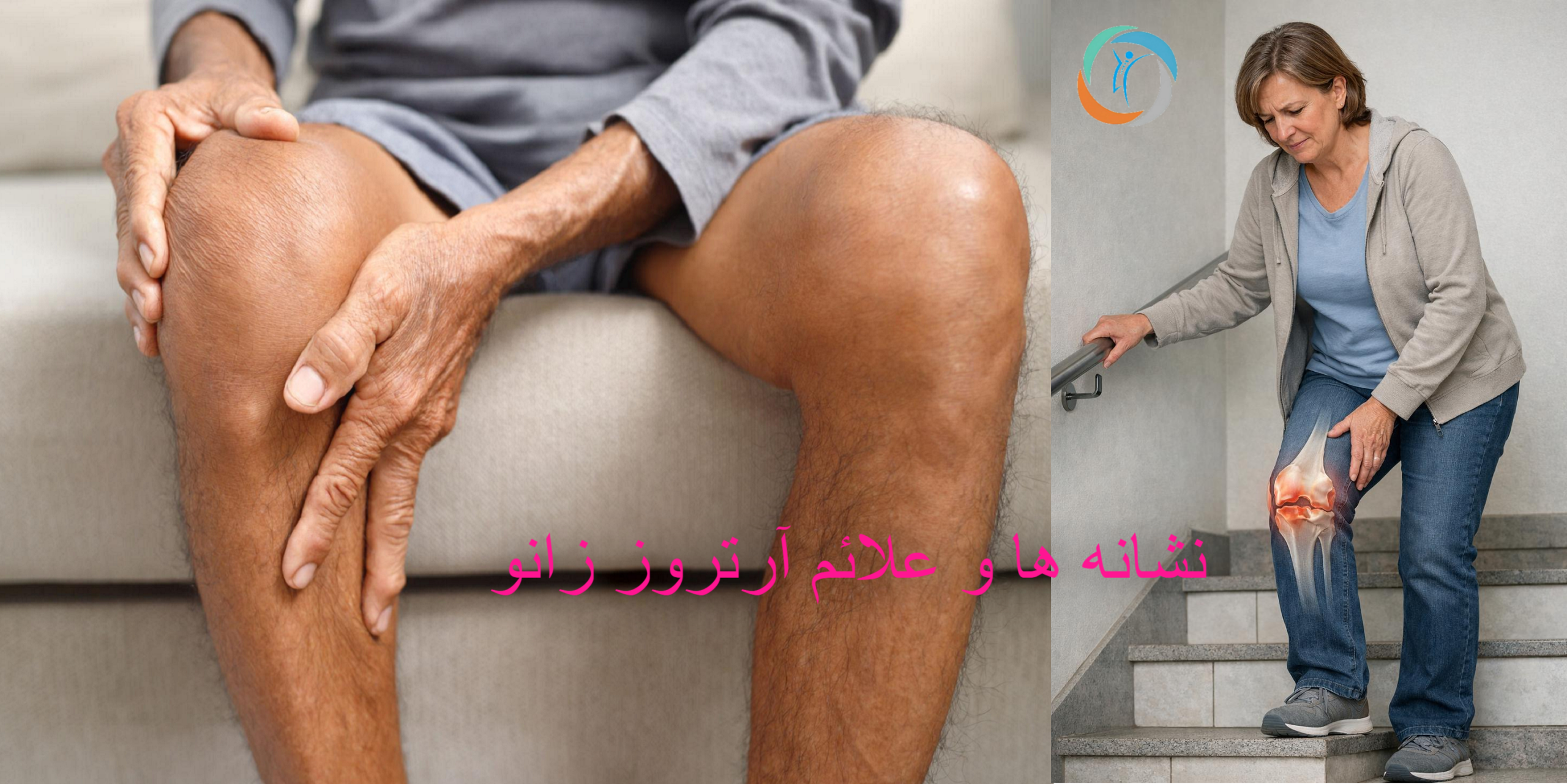 نشانه ها و علائم آرتروز زانو