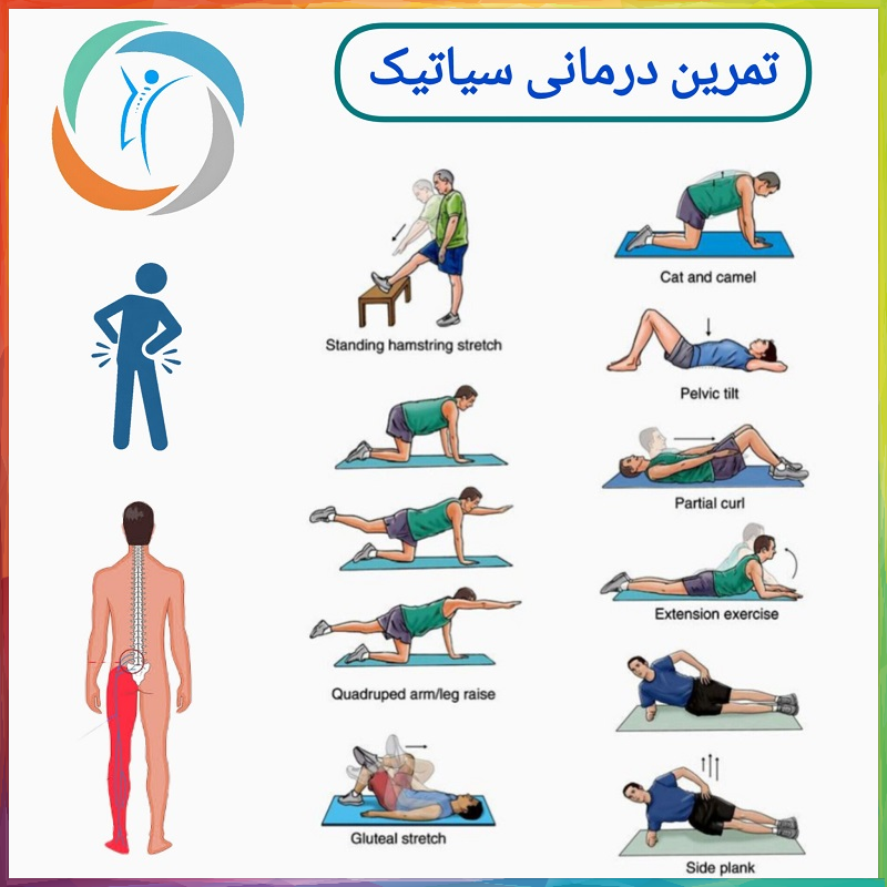 تمرین درمانی سیاتیک؛ ساده و موثر