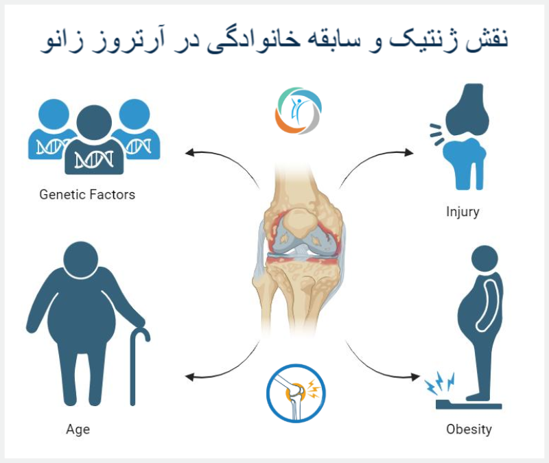 آیا آرتروز زانو از پدر یا مادر به فرزند به ارث می‌رسد؟/ نقش ژنتیک و سابقه خانوادگی در آرتروز زانو