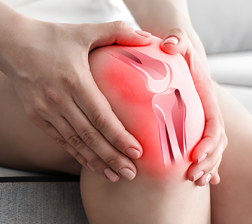 درمان بدون جراحی آرتروز زانو