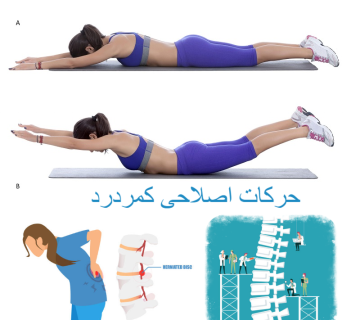 حرکات اصلاحی کمر درد