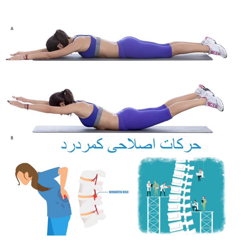 حرکات اصلاحی کمر درد