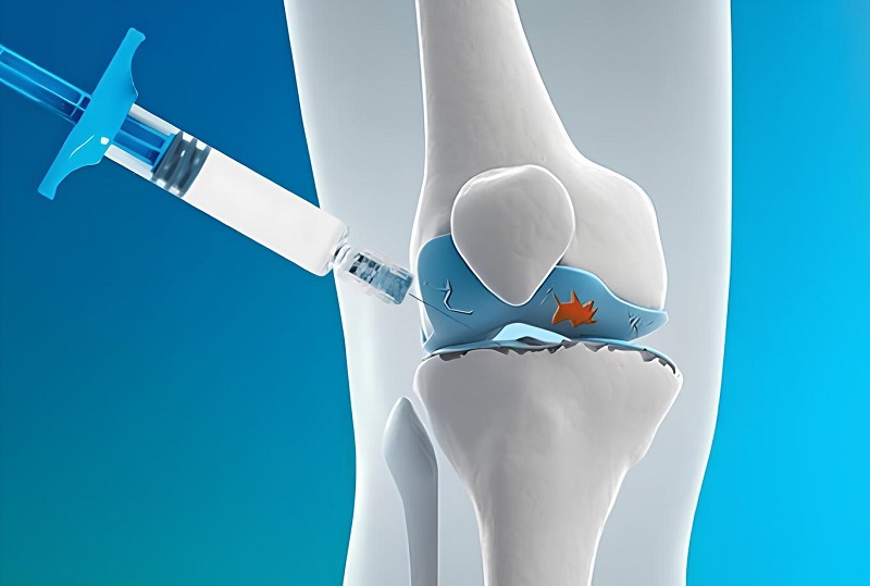 آرتروز زانو و تزریق به داخل زانو