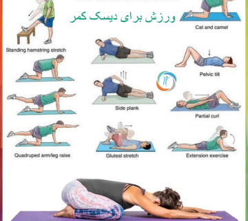 ورزش برای دیسک کمر
