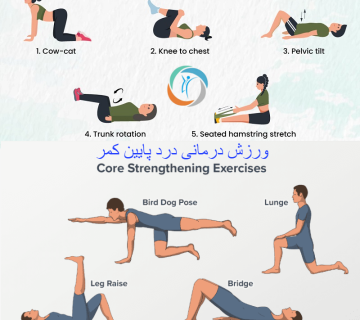 ورزش درمانی درد پایین کمر