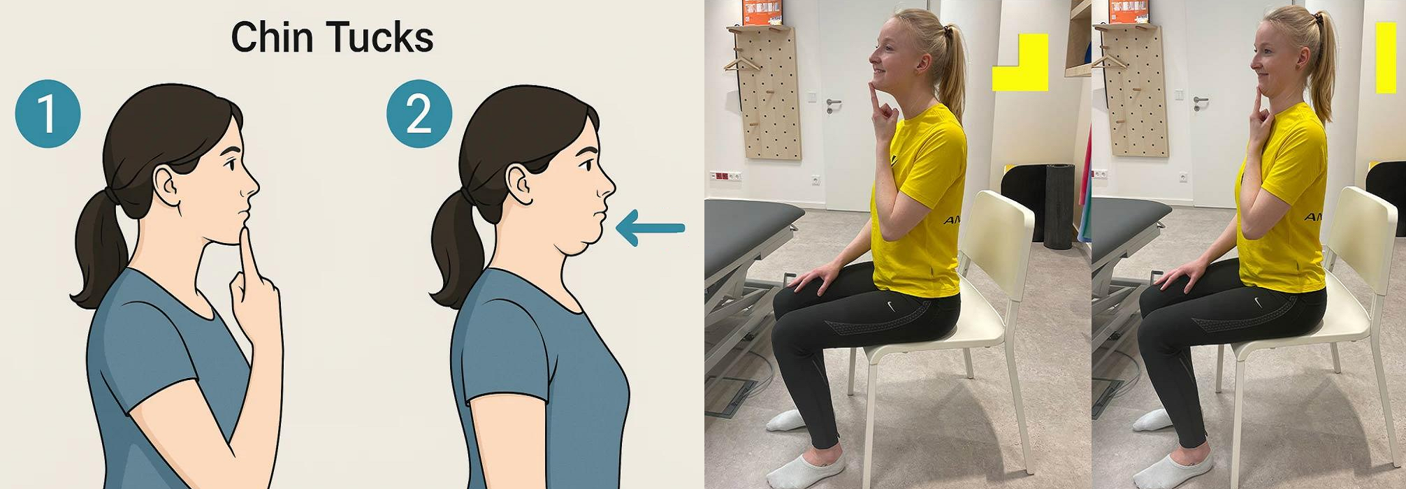 تمرین جمع کردن چانه (Chin Tuck)