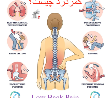 کمردرد چیست؛ درمان و پیشگیری
