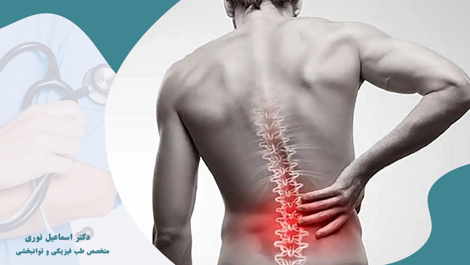 کمر درد چیست؟