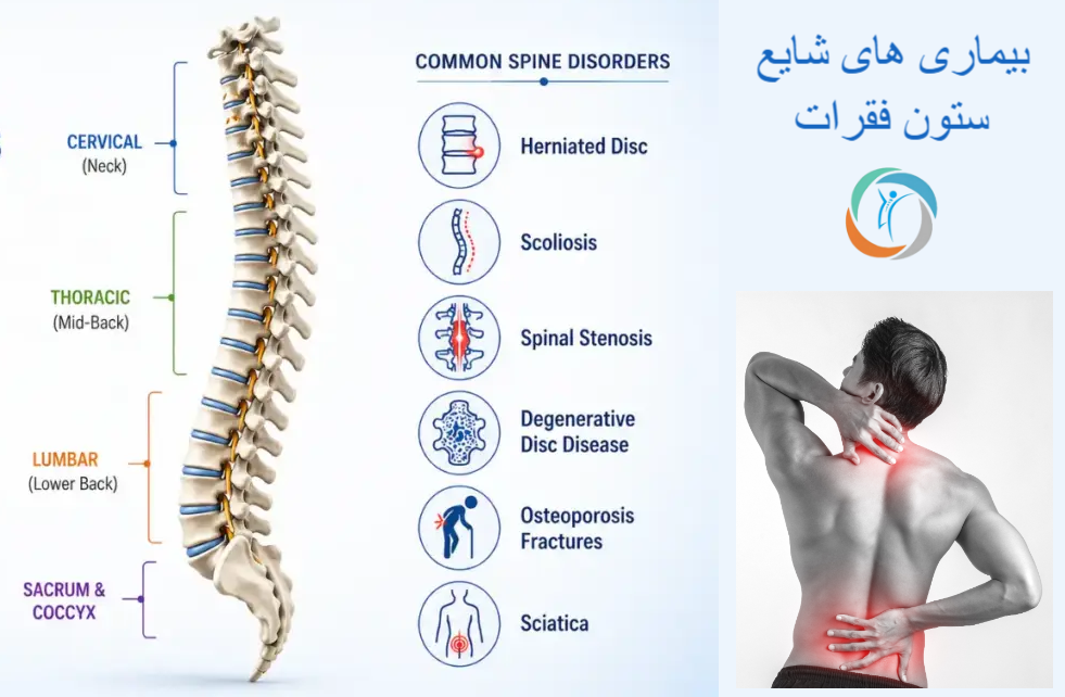 بیماری های شایع ستون فقرات