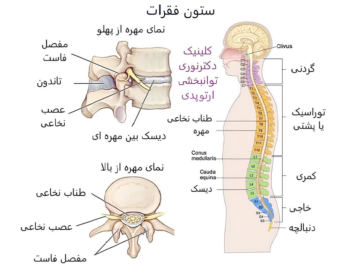 دیسک های بین مهره‌ ای ستون فقرات
