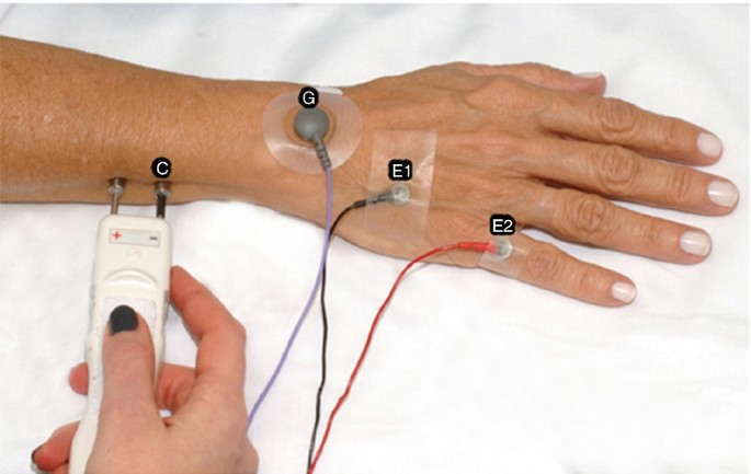 نوار عصب و عضله