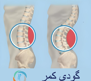 گودی کمر