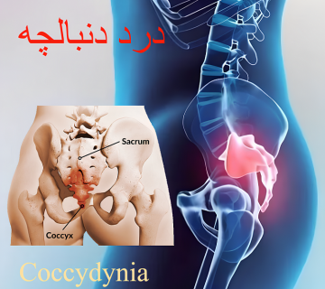 درد دنبالچه