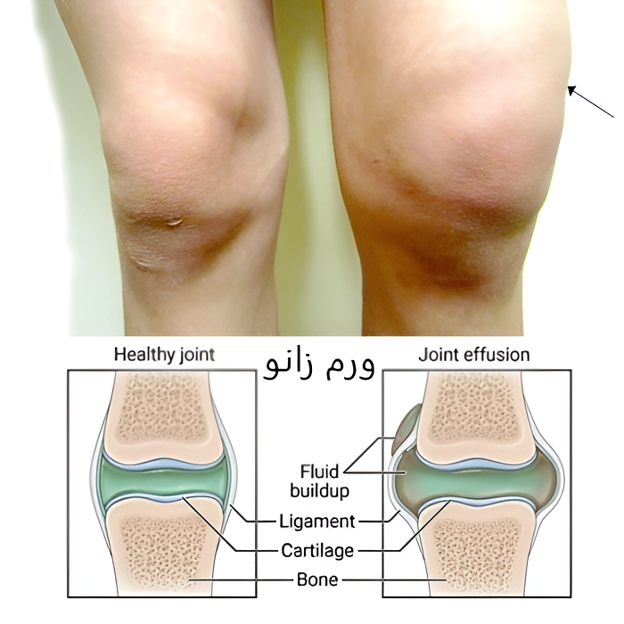 نظرات بیماران کلینیک دکتر نوری/ ورم زانو