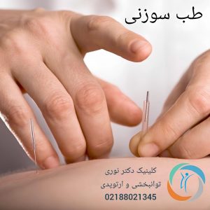 طب سوزنی